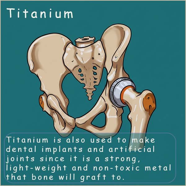 Use of titanium in artificial joints and implants.